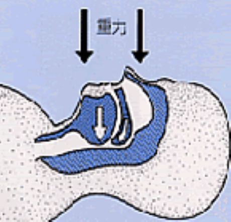 睡眠中の体位の工夫