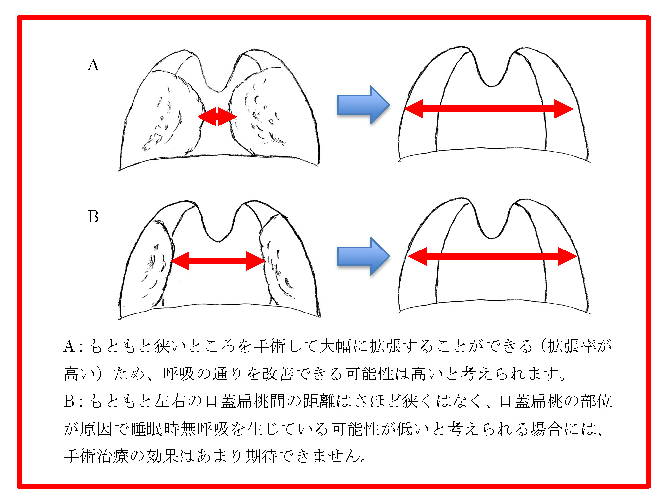 手術すれば良くなる可能性があるのは、どのような場合なのか