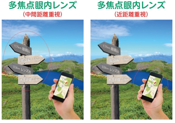 多焦点眼内レンズを希望される方へ